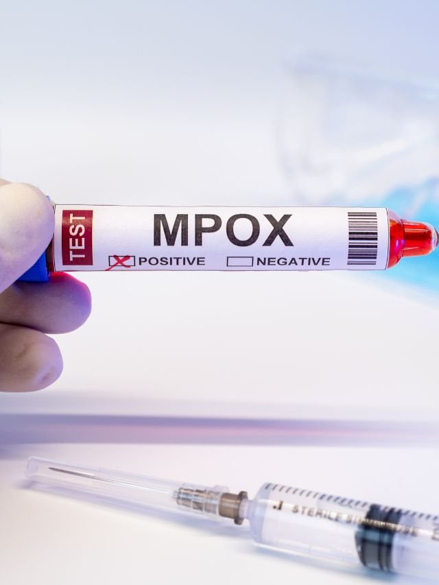 Read more about the article Mpox Detected in India: Traveler from Affected Region Tests Positive